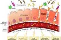 Cos’è la Permeabilità Intestinale (Leaky Gut) e Come Trattarla
