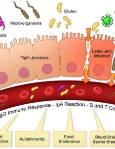 Cos’è la Permeabilità Intestinale (Leaky Gut) e Come Trattarla