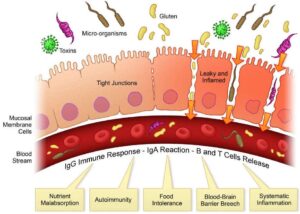 Cos’è la Permeabilità Intestinale (Leaky Gut) e Come Trattarla