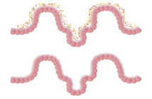 Disbiosi Intestinale: Quando i Batteri Sbagliati Prendono il Sopravvento