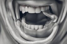 Terapia del Sorriso: come l’umore positivo influisce sulla guarigione